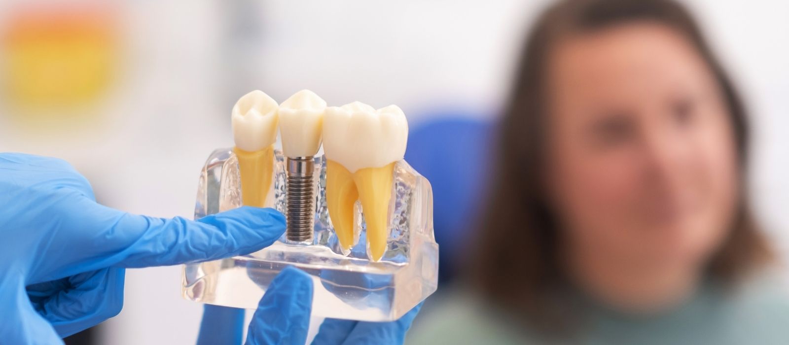 Dental implant model showing titanium screw and artificial tooth root with a blurred patient in the background.